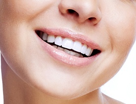 Closeup of flawless smile after direct bonding