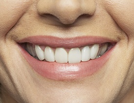 Closeup of healthy smile following scaling and root planing