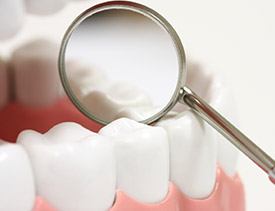 Teeth examined after dental sealants