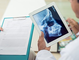 Dentist looking at dental x-rays and patient chart