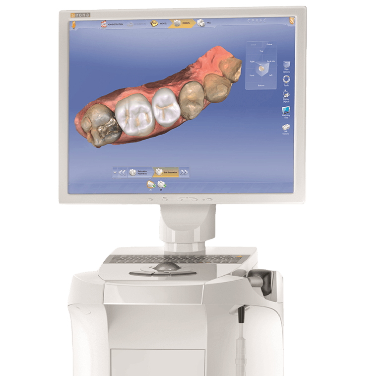 CEREC smile design on computer